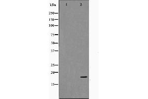 Western blot analysis on HuvEc cell lysate using TP53I11 Antibody. (TP53I11 anticorps  (N-Term))