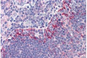 Human Thymus (formalin-fixed, paraffin-embedded) stained with TLR6 antibody ABIN214529 at 5 ug/ml followed by biotinylated goat anti-rabbit IgG secondary antibody ABIN481713, alkaline phosphatase-streptavidin and chromogen. (TLR6 anticorps  (Internal Region))