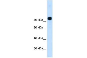 Alpha Actinin 4 antibody used at 0.