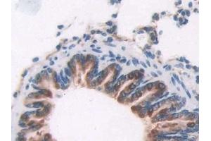 Detection of OAS1 in Rat Lung Tissue using Polyclonal Antibody to 2',5'-Oligoadenylate Synthetase 1 (OAS1) (OAS1 anticorps  (AA 139-358))