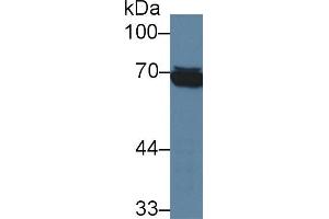 Western blot analysis of Human Raji cell lysate, using Human HSPA1L Antibody (3 µg/ml) and HRP-conjugated Goat Anti-Mouse antibody ( (TPSAB1 anticorps  (AA 161-262))