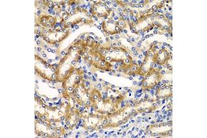 Immunohistochemistry of paraffin-embedded mouse kidney using ZF antibody (ABIN6130814, ABIN6150426, ABIN6150427 and ABIN6223369) at dilution of 1:100 (40x lens).