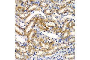 Immunohistochemistry of paraffin-embedded mouse kidney using ZF antibody (ABIN6130814, ABIN6150426, ABIN6150427 and ABIN6223369) at dilution of 1:100 (40x lens). (ZFAND3 anticorps  (AA 1-227))