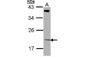 WB Image Sample (30 ug of whole cell lysate) A: Molt-4 , 12% SDS PAGE antibody diluted at 1:1000 (ZNHIT1 anticorps)