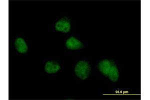 Immunofluorescence of purified MaxPab antibody to COPS8 on HeLa cell.