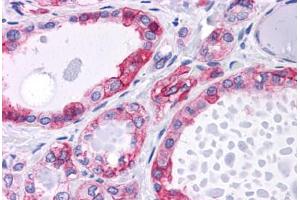 Human Thyroid: Formalin-Fixed, Paraffin-Embedded (FFPE) (CTNNB1 anticorps)