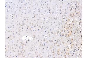 ABIN7094610 and ABIN7098660 at 1/100 staining Rat brain tissue by IHC-P.