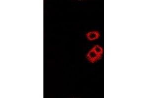 Immunofluorescent analysis of Tryptase alpha/beta staining in Hela cells. (TPSAB1 anticorps)