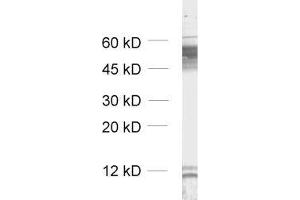 dilution: 1 : 1000, sample: unboiled synaptic membrane fraction of rat brain (LP1) (GABRB2 anticorps  (AA 343-430))