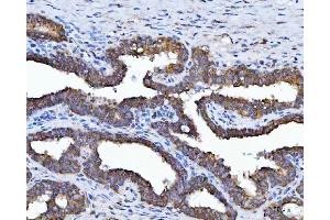 IHC analysis of HSD17B7 using anti-HSD17B7 antibody (ABIN7600174). (HSD17B7 anticorps  (AA 16-336))