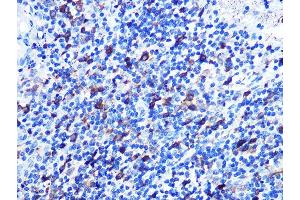 Immunohistochemistry of paraffin-embedded human appendix using Stathmin 1 Rabbit mAb (ABIN1678518, ABIN3018873, ABIN3018874 and ABIN7101680) at dilution of 1:100 (40x lens). (Stathmin 1 anticorps)