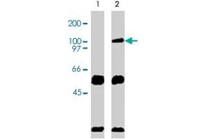 Immunoprecipation results using Western blot analysis. (VAV2 anticorps  (AA 578-878))