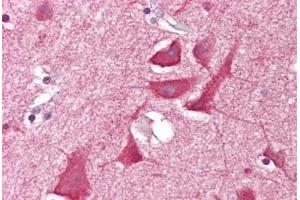Anti-NKX3-2 antibody IHC staining of human brain, cortex. (NKX3-2 anticorps  (Internal Region))
