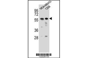 Western blot analysis in MDA-MB453,CEM cell line lysates (35ug/lane). (FOXD4 anticorps  (AA 182-210))