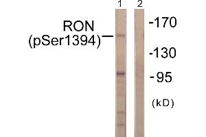 Western blot analysis of extracts from HeLa cells, treated with TNF-a (20ng/ml, 2mins), using CD136/RON (Phospho-Ser1394) antibody. (MST1R anticorps  (pSer1394))