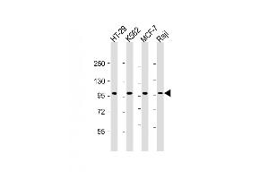 All lanes : Anti-TPX2 Antibody at 1:2000 dilution Lane 1: HT-29 whole cell lysate Lane 2: K562 whole cell lysate Lane 3: MCF-7 whole cell lysate Lane 4: Raji whole cell lysate Lysates/proteins at 20 μg per lane. (TPX2 anticorps  (AA 1-531))