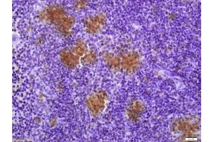 Formalin-fixed and paraffin embedded mouse spleen labeled with Anti-TXNRD1 Polyclonal Antibody, Unconjugated (ABIN1386102) at 1:200 followed by conjugation to the secondary antibody and DAB staining