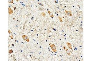 IHC-P: Dopamine Receptor D3 antibody testing of rat brain tissue (DRD3 anticorps  (C-Term))
