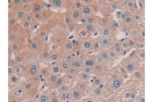 Detection of ITGb1 in Human Liver Tissue using Polyclonal Antibody to Integrin Beta 1 (ITGb1)