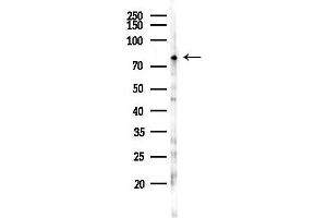 anti-Procollagen-Lysine, 2-Oxoglutarate 5-Dioxygenase 3 (PLOD3) (C-Term) antibody