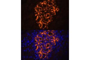 Immunofluorescence analysis of rat pancreas using PNLIPRP2 antibody (ABIN6130643, ABIN6145842, ABIN6145843 and ABIN6216695) at dilution of 1:100. (PNLIPRP2 anticorps  (AA 301-470))