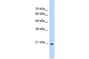 WB Suggested Anti-GINS2 Antibody Titration:  0. (GINS2 anticorps  (C-Term))