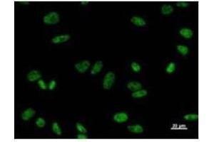 Immunostaining analysis in HeLa cells.