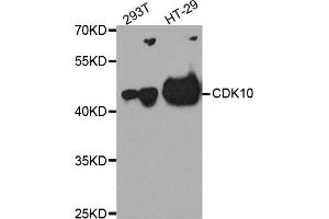 Western blot analysis of extracts of various cell lines, using CDK10 antibody (ABIN5975358) at 1/1000 dilution. (CDK10 anticorps)