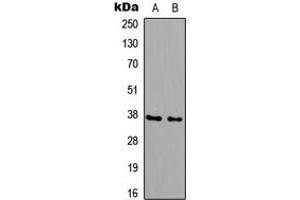 Western blot analysis of B3GALT6 expression in HeLa (A), PC12 (B) whole cell lysates.