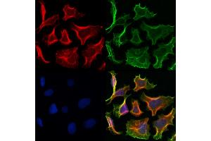 ABIN6260811 and ABIN6272991 staining Hela cells by IF/ICC. (CHMP2A anticorps  (Internal Region))