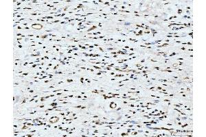 IHC analysis of ARL6IP6 using anti-ARL6IP6 antibody (ABIN7603020).
