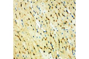 Anti-Fatty Acid Binding Protein 5 antibody, IHC(P) IHC(P): Mouse Cardiac Muscle