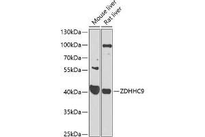 Western blot analysis of extracts of various cell lines, using ZDHHC9 antibody (ABIN6131130, ABIN6150420, ABIN6150421 and ABIN6223988) at 1:1000 dilution. (ZDHHC9 anticorps  (AA 250-364))