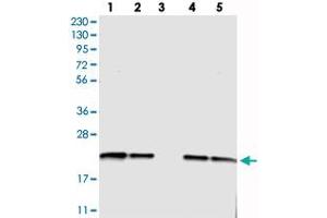 Western blot analysis of Lane 1: RT-4, Lane 2: U-251 MG, Lane 3: Human Plasma, Lane 4: Liver, Lane 5: Tonsil with C6orf108 polyclonal antibody  at 1:250-1:500 dilution.