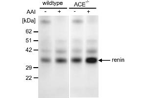 Western blot from kidney tissue using an antibody against against renin in the wildtype and ACE−/− mice treated with vehicle or aristolochic acid I (AAI).