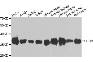 Western blot analysis of extracts of various cell lines, using LDHB antibody (ABIN5975613) at 1/1000 dilution. (LDHB anticorps)
