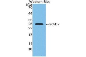 Western Blotting (WB) image for anti-Insulin-Like Growth Factor 1 Receptor (IGF1R) (AA 763-955) antibody (ABIN1868503) (IGF1R anticorps  (AA 763-955))