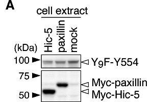 Git1 phosphorylation at Tyr-554 was enhanced by co-expression of paxillin. (Myc Tag anticorps)