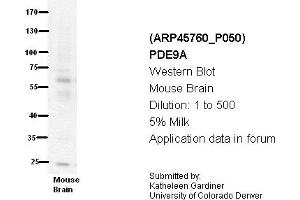 Image no. 1 for anti-phosphodiesterase 9A (PDE9A) (N-Term) antibody (ABIN2782354) (PDE9A anticorps  (N-Term))