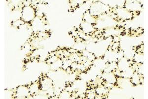 ABIN6272956 at 1/100 staining Mouse lung tissue by IHC-P. (C9ORF72 anticorps  (Internal Region))