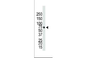 Western blot analysis of anti-BR1B Pab ap2005b in NCI- cell lysate.
