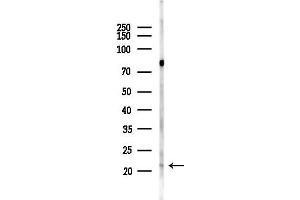 anti-Phosphatidylethanolamine N-Methyltransferase (PEMT) antibody