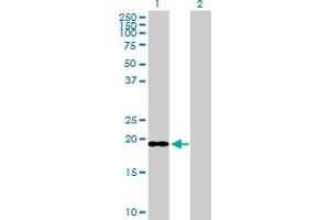 Western Blot analysis of ICT1 expression in transfected 293T cell line by ICT1 MaxPab polyclonal antibody. (ICT1 anticorps  (AA 1-206))