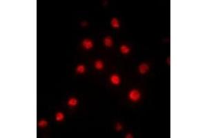 Immunofluorescent analysis of RBBP5 staining in Hela cells. (RBBP5 anticorps)