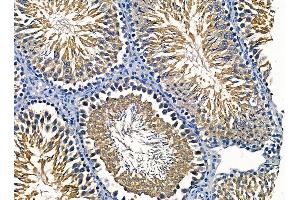 ABIN7095404 and ABIN7099461 at 1/100 staining rat testis tissue by IHC-P. (HS6ST2 anticorps)