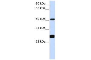 WB Suggested Anti-SERPINA3 Antibody Titration: 0. (SERPINA3 anticorps  (Middle Region))