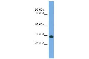 CENPH antibody used at 1 ug/ml to detect target protein. (CENPH anticorps  (N-Term))