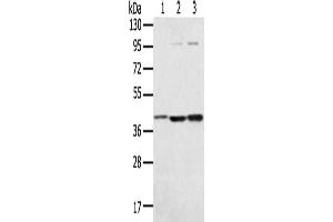 Gel: 8 % SDS-PAGE, Lysate: 40 μg, Lane 1-3: Hepg2 cells, TM4 cells, Raw264. (Syntaxin 18 anticorps)