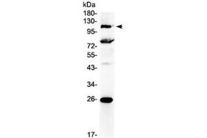 Western blot testing of human 22RV1 cell lysate with NFAT4 antibody at 0. (NFATC3 anticorps)