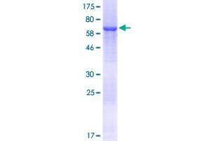 Image no. 1 for 5-Azacytidine Induced 2 (AZI2) (AA 1-392) protein (GST tag) (ABIN1346257)